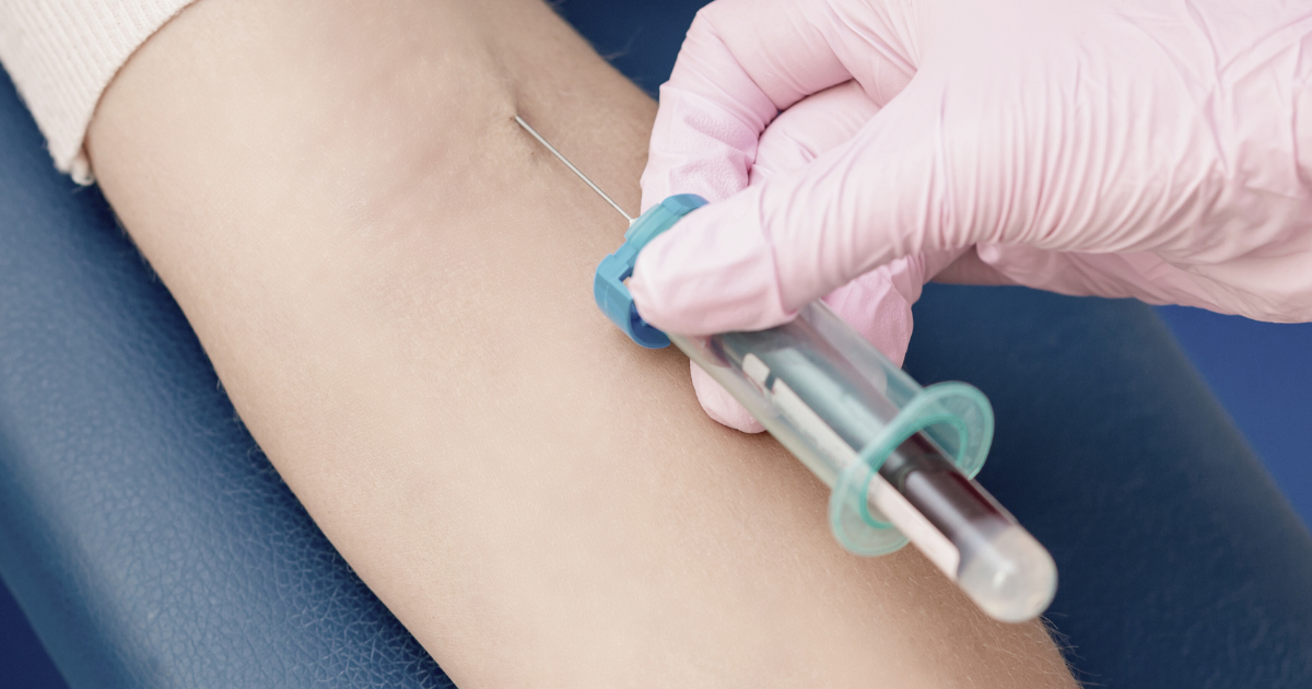 Blown Vein From Blood Draw Blood Draw Risks Phlebotomy Now