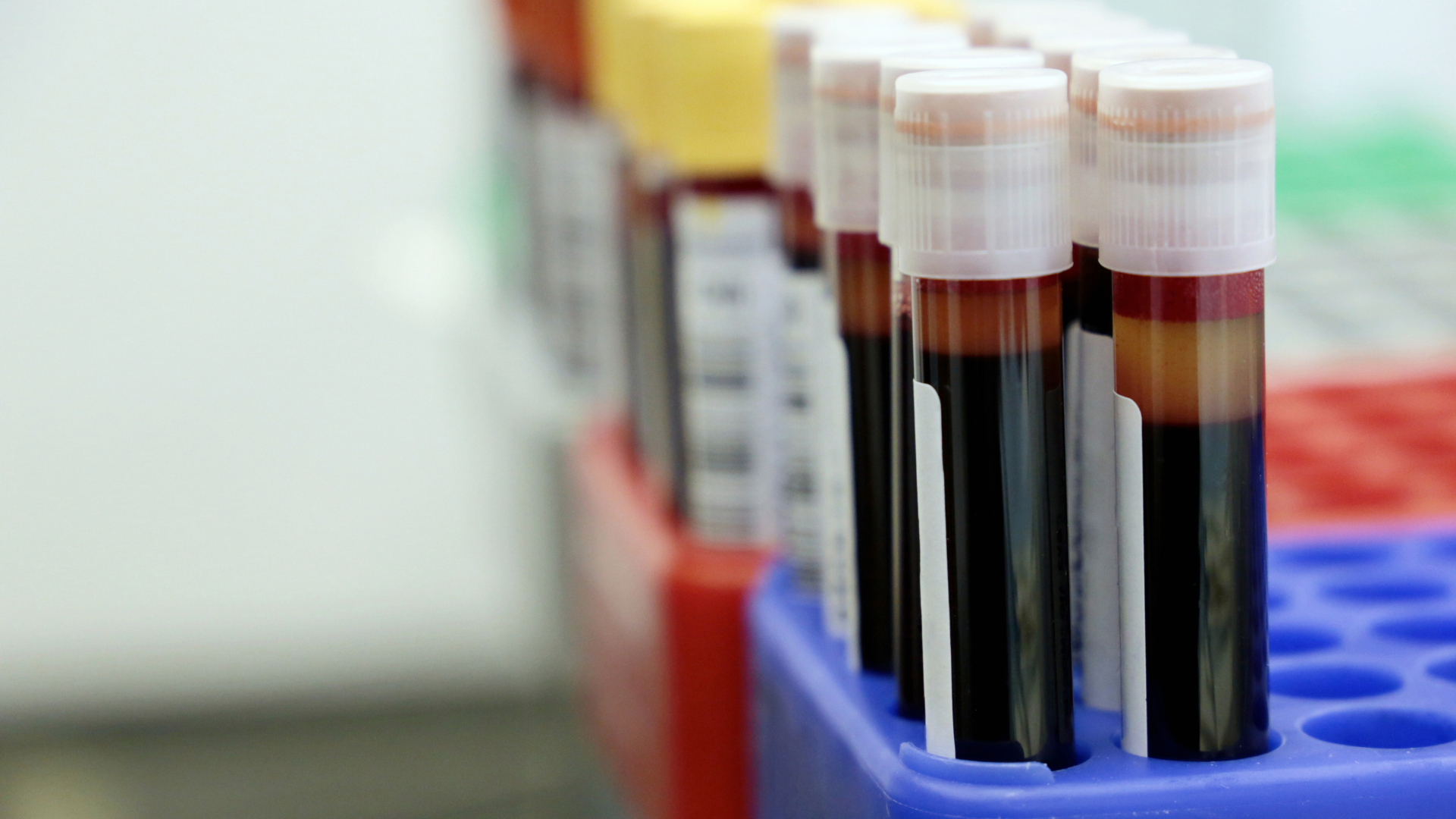 How Many Vials of Blood in a Pint? Guide for Phlebotomists and Donors