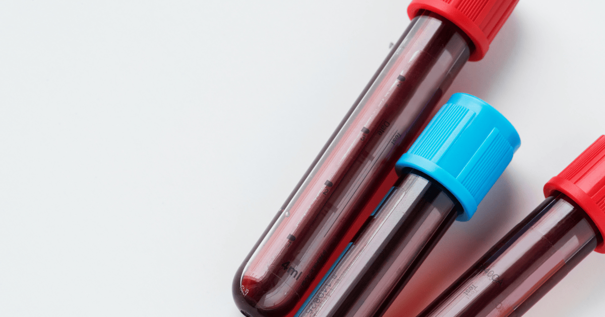 Hemolysis: Understanding and Managing Red Blood Cell Destruction