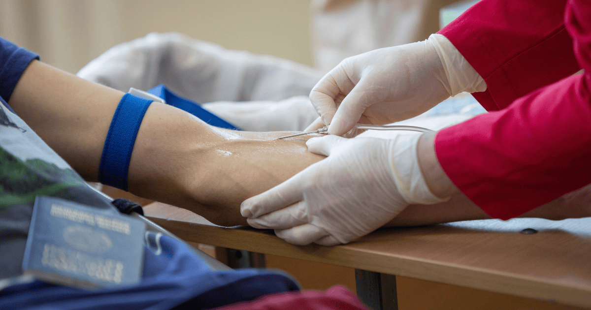 What Angle of the Needle Facing for Phlebotomy: A Blood Draw Guide