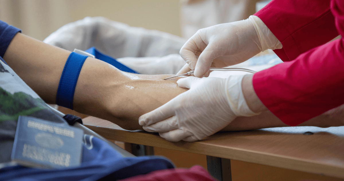 Collapsed Vein: Understanding, Symptoms, Causes, and Treatment